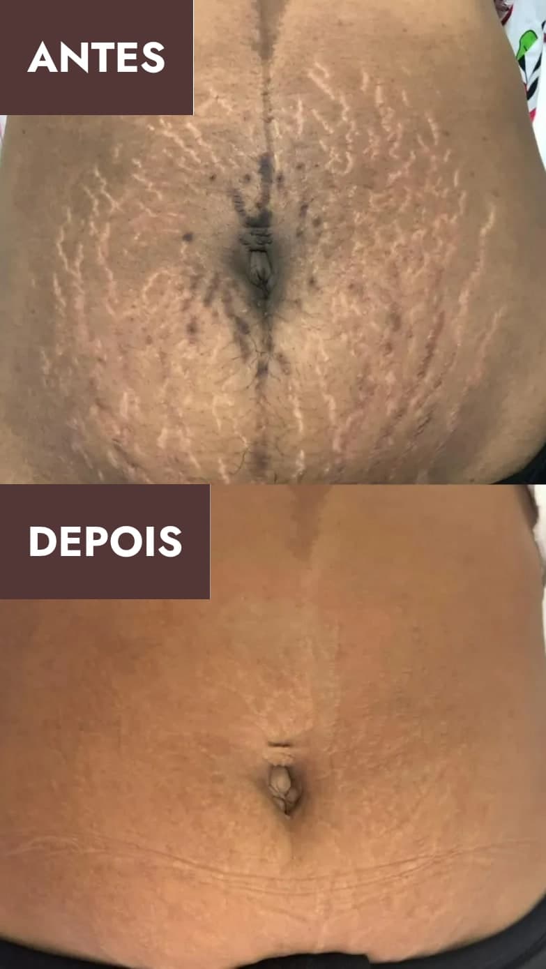 Antes e depois 6