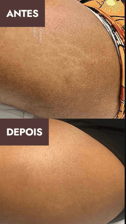 Antes e depois 8